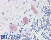 Anti-TNFSF13 / APRIL Antibody (C-Terminus) IHC-plus LS-B4176