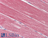 Anti-IDE Antibody (Internal) IHC-plus LS-B4179