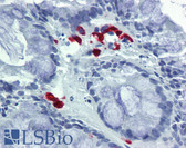 Anti-FASLG / Fas Ligand Antibody IHC-plus LS-B4195