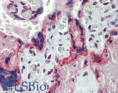 Anti-MMP3 Antibody IHC-plus LS-B4196