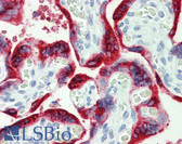 Anti-GH / Growth Hormone Antibody IHC-plus LS-B4199