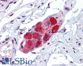 Anti-VRL1 / TRPV2 Antibody IHC-plus LS-B4211