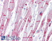 Anti-ACTN2 Antibody IHC-plus LS-B4217