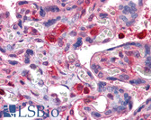 Anti-GDI2 Antibody IHC-plus LS-B4219