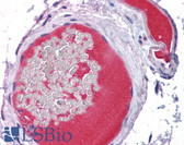Anti-PROC / Protein C Antibody IHC-plus LS-B4229