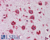 Anti-Trypsin Antibody IHC-plus LS-B4236