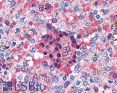 Anti-HNE / Neutrophil Elastase Antibody (clone 203) IHC-plus LS-B4274