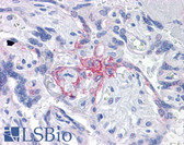 Anti-BUB1B / BubR1 Antibody (clone 2G5) IHC-plus LS-B4289