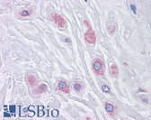 Anti-BUB1B / BubR1 Antibody (clone 3F2) IHC-plus LS-B4291