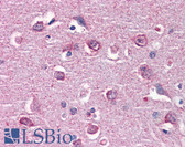 Anti-CAMK2B / CaMKII Beta Antibody (clone S11) IHC-plus LS-B4292
