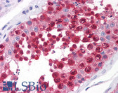 Anti-CSE1L Antibody (clone 3F8) IHC-plus LS-B4307
