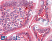 Anti-COMT Antibody (Internal) IHC-plus LS-B4343