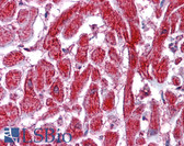 Anti-PDIA2 Antibody (Internal) IHC-plus LS-B4348