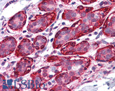 Anti-THRA / THR Alpha Antibody (Internal) IHC-plus LS-B4351