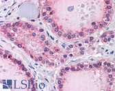 Anti-PTPRM / PTP Mu Antibody (Internal) IHC-plus LS-B4352