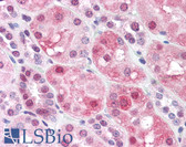 Anti-DNMT / DNMT1 Antibody (Internal) IHC-plus LS-B4353