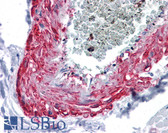 Anti-MYOC / Myocilin Antibody (clone 4F8) IHC-plus LS-B4382