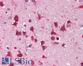 Anti-OAS1 Antibody (clone 2D4) IHC-plus LS-B4388