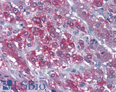 Anti-CAMK2A / CaMKII Alpha Antibody (Internal) IHC-plus LS-B4390