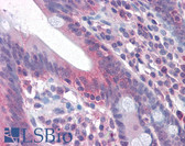 Anti-CD95 / FAS Antibody (Internal) IHC-plus LS-B4405