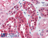 Anti-GPI Antibody (N-Terminus) IHC-plus LS-B4413