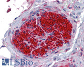 Anti-SGCB / SGC / Sarcoglycan Beta Antibody (clone 1C10) IHC-plus LS-B4415