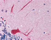 Anti-PTPN11 / SHP-2 / NS1 Antibody (C-Terminus) IHC-plus LS-B4418