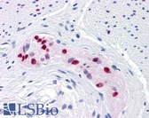 Anti-SOX9 Antibody (clone 3F11) IHC-plus LS-B4421