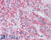 Anti-MTA1 Antibody (Internal) IHC-plus LS-B4428