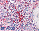 Anti-TLN1 / Talin Antibody (clone 5C1) IHC-plus LS-B4430