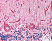 Anti-BCAP31 / BAP31 Antibody (C-Terminus) IHC-plus LS-B4438