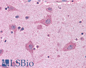 Anti-ACSL4 / FACL4 Antibody (C-Terminus) IHC-plus LS-B4440