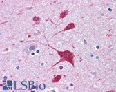 Anti-LRRK2 Antibody (C-Terminus) IHC-plus LS-B4447