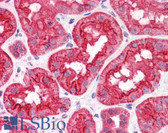 Anti-ABHD5 Antibody (Internal) IHC-plus LS-B4458