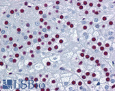 Anti-SF1 Antibody (clone 2E12) IHC-plus LS-B4465