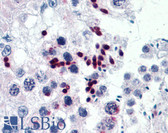 Anti-CGGBP1 Antibody (clone 1D11) IHC-plus LS-B4470