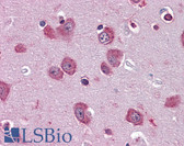 Anti-PER2 Antibody (clone 5C10) IHC-plus LS-B4477
