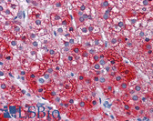 Anti-SH3BP5 / SAB Antibody (clone 2B3) IHC-plus LS-B4485