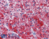 Anti-SH3BP5 / SAB Antibody (clone 2B3) IHC-plus LS-B4485