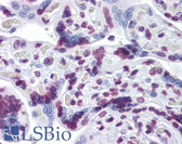 Anti-RBM5 / G15 Antibody (clone 2B6) IHC-plus LS-B4492