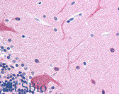 Anti-TUBB3 / Tubulin Beta 3 Antibody (C-Terminus, clone TU-20) IHC-plus LS-B4499