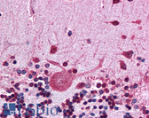 Anti-HSP90 Beta Antibody (N-Terminal, clone MBH90B) IHC-plus LS-B4505