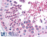 Anti-SMARCA4 / BRG1 Antibody (C-Terminus, clone BRG-01) IHC-plus LS-B4506