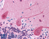 Anti-GRB2 Antibody (C-Terminus) IHC-plus LS-B4508