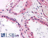Anti-MCF2L / DBS Antibody (clone 1D11) IHC-plus LS-B4519