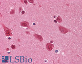 Anti-TDP-43 / TARDBP Antibody (clone 2E2-D3) IHC-plus LS-B4521