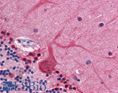 Anti-CORO1B Antibody (clone 1E7) IHC-plus LS-B4533