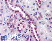 Anti-STK33 Antibody (clone 3F10) IHC-plus LS-B4535