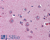 Anti-NTNG2 / Netrin G2 Antibody (clone 4F11) IHC-plus LS-B4540