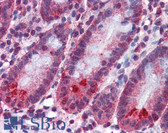 Anti-SPSB2 Antibody (clone 1E6) IHC-plus LS-B4541